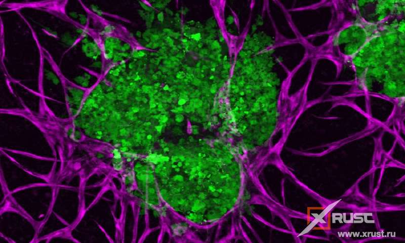 Клетки рака чувствуют окружение